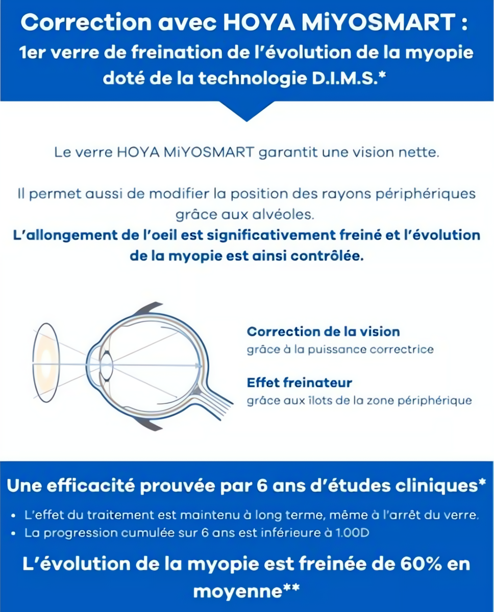 Optique Codet Opticien Avranches Correction Avec HOYA MIYOSMART